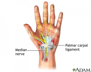 Carpal Tunnel - NeurotexasNeurotexas