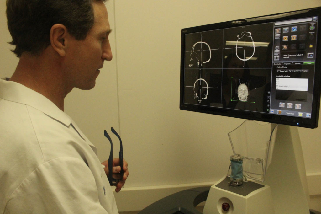 Robot used in Lakeway hospital enables patient-friendly brain surgery